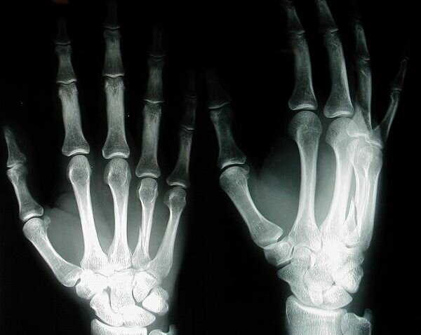 radiografias rayos x